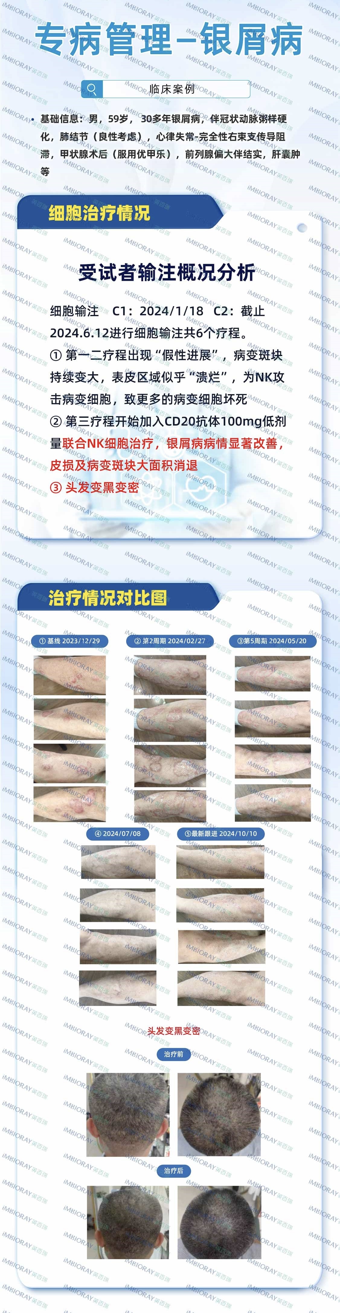 癌症管理 癌症管理