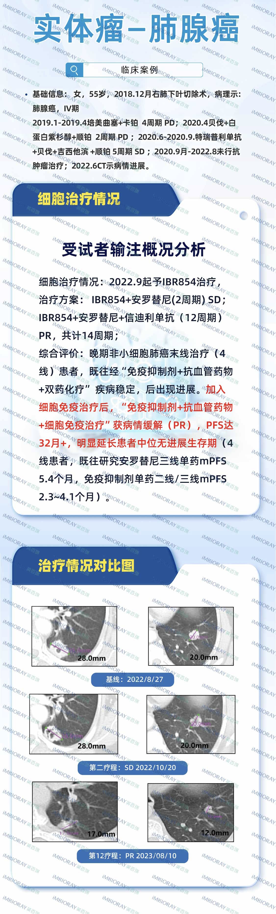 癌症管理 癌症管理